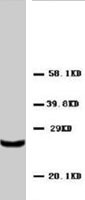 PAB8015 - TIMP4