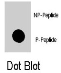 PAB8069 - APG16L / ATG16L1