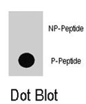 PAB8084 - B-Raf proto-oncogene