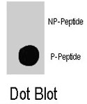 PAB8093 - TSC2 / Tuberin