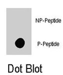 PAB8096 - B-Raf proto-oncogene