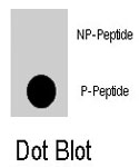 PAB8105 - NFATC2