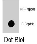 PAB8108 - TSC2 / Tuberin
