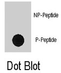 PAB8134 - RPS6KA1