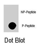 PAB8141 - AKT3 / PKB gamma
