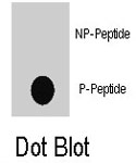 PAB8143 - TSC1 / Hamartin