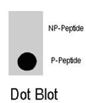 PAB8147 - EIF4E