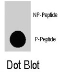 PAB8151 - TSC2 / Tuberin