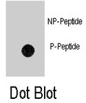 PAB8155 - Anthrax toxin receptor 1 / ANTXR1