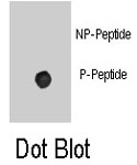 PAB8156 - Beta-2 adrenergic receptor