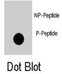 PAB8161 - GIT1