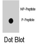 PAB8162 - CD220 / INSR