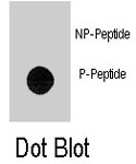 PAB8171 - Tektin-1 (TEKT1)