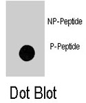 PAB8179 - Prolactin / PRL