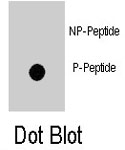 PAB8181 - ZBTB16