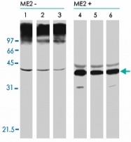 PAB8182 - CD5L / API6