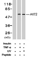 PAB8183 - AKT2 / PKB beta