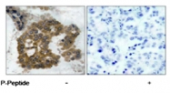 PAB8183 - AKT2 / PKB beta