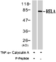 PAB8192 - RELA / NF-kB p65