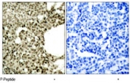 PAB8194 - STAT1
