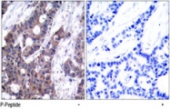 PAB8195 - Stathmin / STMN1