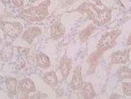 PAB8451 - XCT / SLC7A11