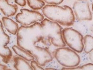 PAB8457 - SLC22A8 / OAT3