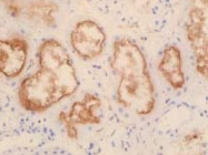 PAB8458 - SLC22A11 / OAT4