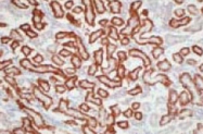 PAB8460 - SLC22A6 / OAT1