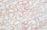 PAB8460 - SLC22A6 / OAT1