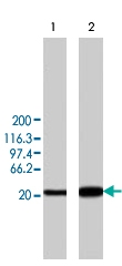 PAB8462 - CAMK2D