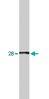 PAB8468 - SIAH1