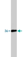 PAB8469 - SIAH2