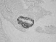 PAB8472 - Insulin promoter factor 1