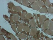 PAB8480 - Chemokine-like factor