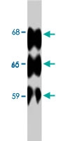 PAB8481 - MAPT / TAU