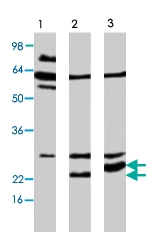 PAB8483 - APH1A