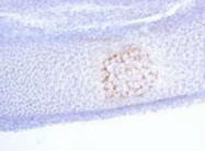 PAB8484 - Matrix Gla Protein