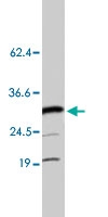 PAB8488 - HMGB3