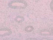 PAB8493 - 17-beta HSD8 / HSD17B8