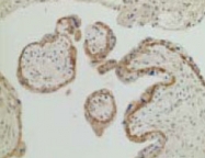 PAB8494 - SEMA3B