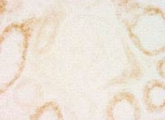 PAB8498 - Tensin-2 / TNS2