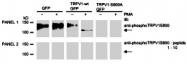 PAB8499 - TRPV1 / Vanilloid receptor 1