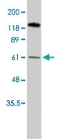 PAB8500 - PPAR-gamma
