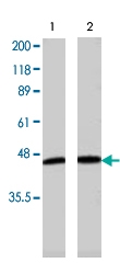 PAB8501 - Adiponectin Receptor 1