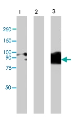 PAB8503 - TRPV4 / Vanilloid receptor-like protein 2