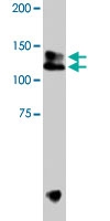 PAB8504 - TRPA1