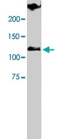 PAB8504 - TRPA1