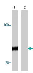 PAB8518 - Phototropin-1