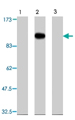 PAB8519 - FARP2
